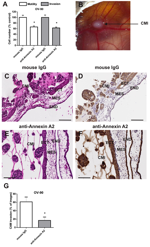 Annexin A2 promotes OV-90 cell motility and invasion