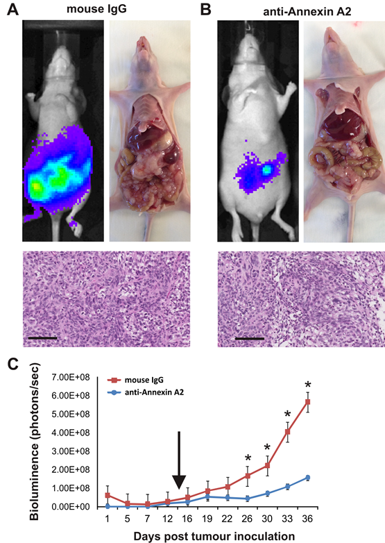 Annexin A2 promotes growth and metastasis of SKOV-3 cells.