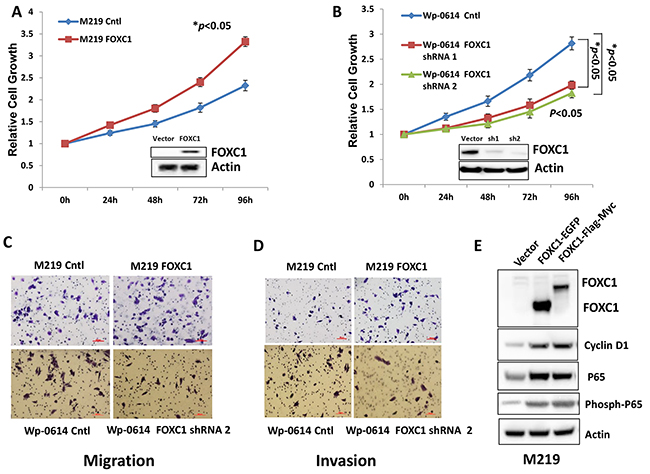 FOXC1 promotes proliferation, migration and invasion of melanoma cells.