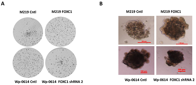 FOXC1 promotes colony formation and growth in 3D matrigel.