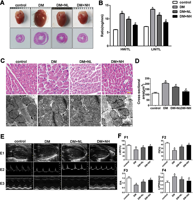Neferine attenuated diabetes-induced myocardial remodeling in vivo.