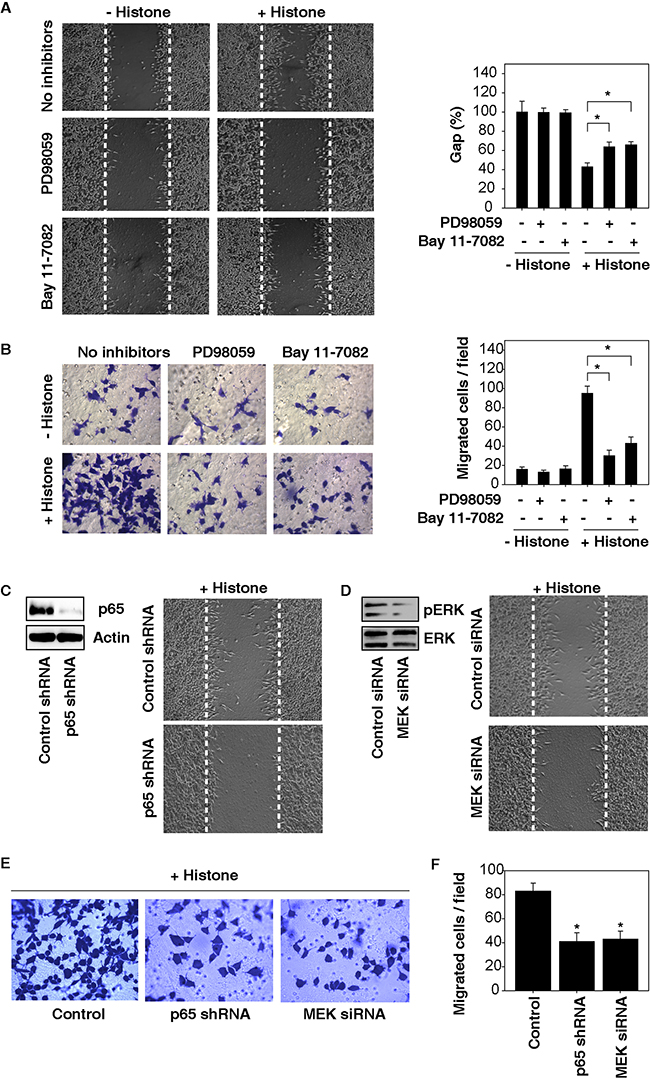 Activation of the MAPK/ERK-NF-&#x03BA;B pathway contributes to histone-induced HCC cell migration and invasion.