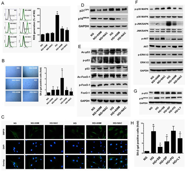 Antcin M inhibits HG-induced senescence in HNDFs.
