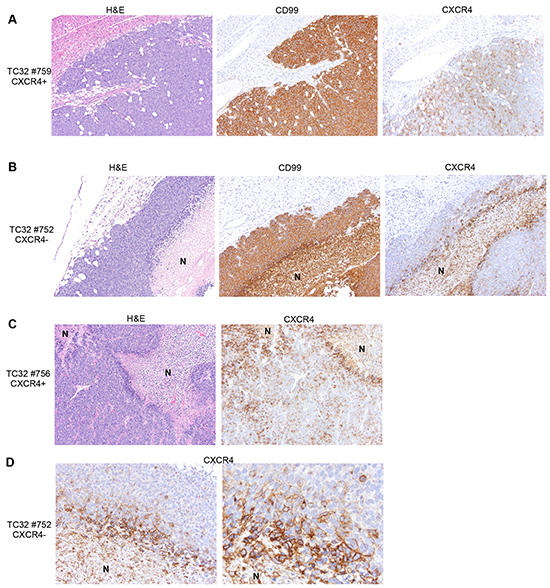 Heterogeneity of CXCR4 expression is evident in tumors irrespective of CXCR4 status at the time of injection.
