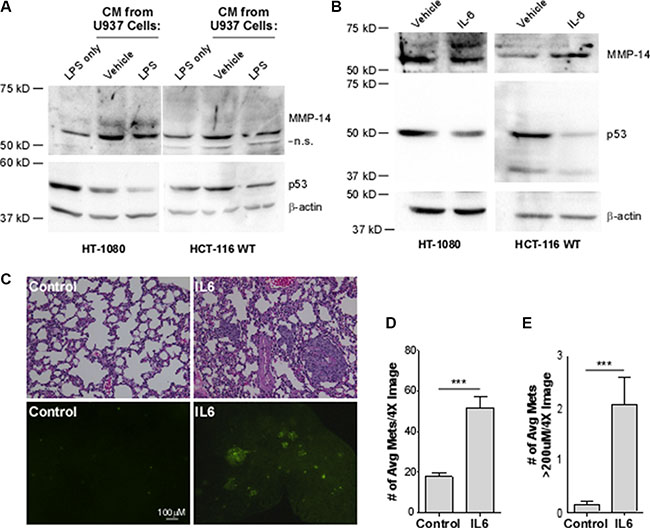 Interleukin-6 decreases p53 levels, leading to a concomitant increase in MMP-14 expression in HT-1080 and HCT-116 WT cells and drives metastasis and growth of HT-1080 cancer cells