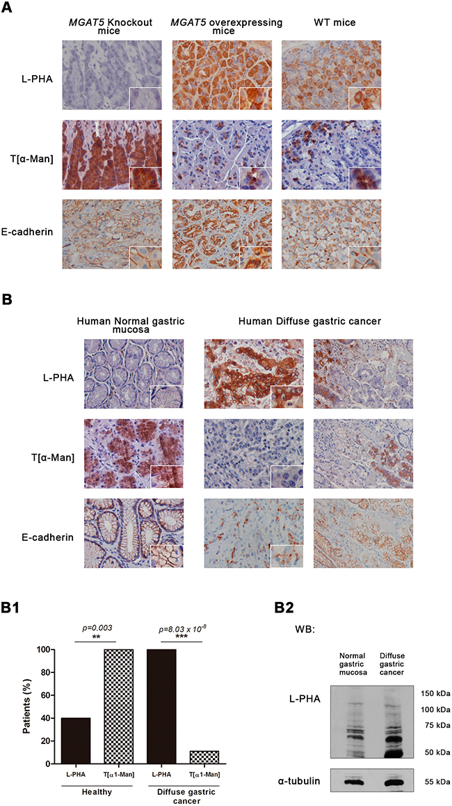 Interplay between GnT-V &#x2013; mediated N-glycosylation and O-mannosylation in vivo.