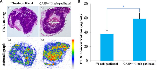 Representative autoradiographs (a2, b2) and corresponding H&#x0026;E images (a1, b1) of 30 &#x03BC;m tumor slices from W256 tumor-bearing rats (A) and the intratumoral distribution of paclitaxel (B) at 24 h post i.v.