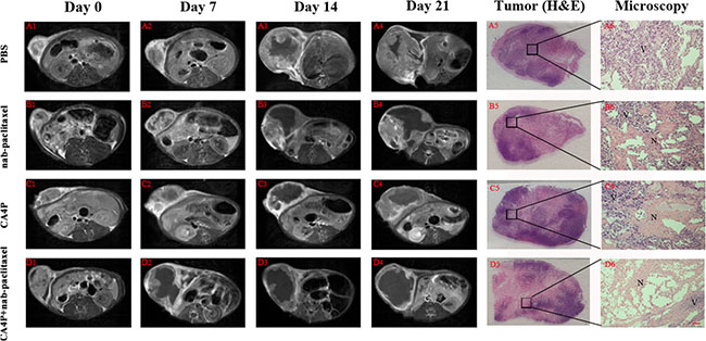 Contrast enhanced T1 (CE-T1) MR images of representative tumor bearing rats from 4 groups at day 0 (A1-D1), 7 (A2-D2), 14 (A3-D3), 21 (A4-D4).