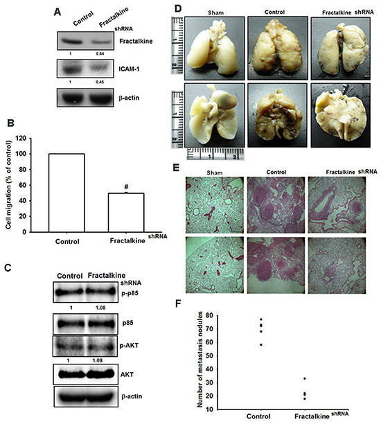 Knockdown of fractalkine inhibits cell migration ability and lung metastasis in osteosarcoma.