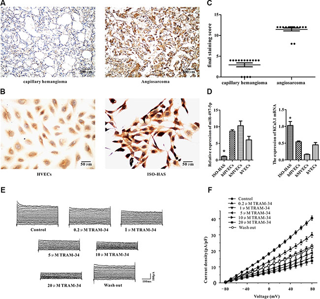 Expression of miR-497-5p and KCa3.1 in angiosarcoma specimens, cell lines, and cultured endothelial cells of varied origin.