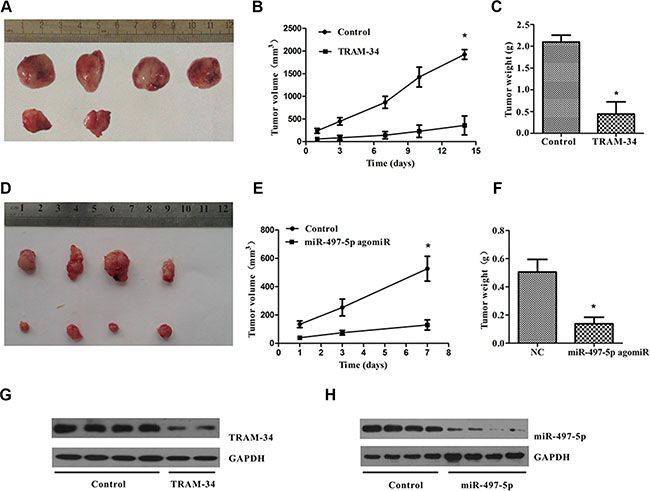 KCa3.1 blockade or miR-497-5p overexpression suppressed the development of angiosarcoma tumors in nude mice.