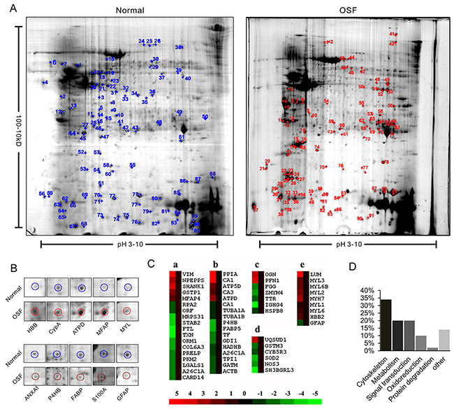 Proteomic identification of differently expressed proteins between normal and OSF tissue.