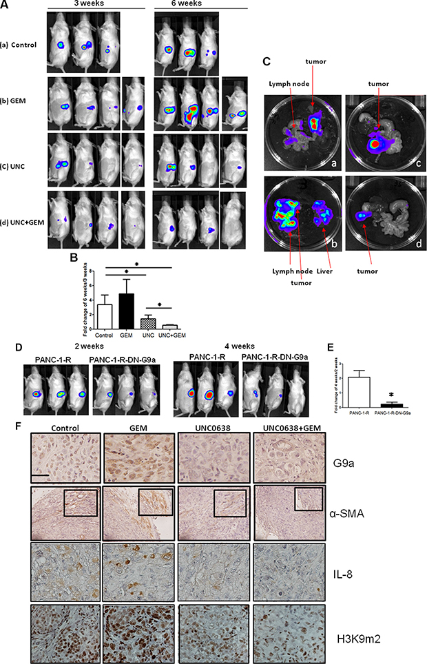 G9a inhibitor overrided GEM resistance and suppressed tumor growth and metastasis of GEM-resistant pancreatic cancer cells.