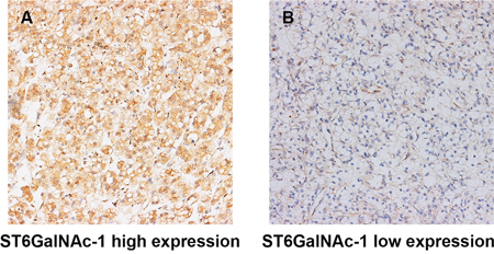 Representative photographs of ST6GalNAc-1 immunostaining.