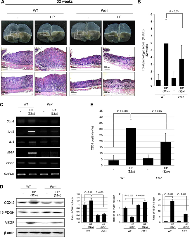 Significantly attenuated tumorigenesis in Fat-1 TG mice at 32 weeks of H. pylori infection.
