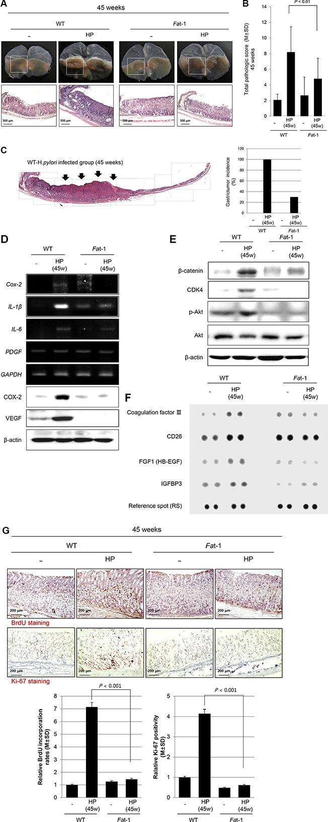 Long-term efficacy of &#x03C9;-3 PUFA on H. pylori-induced gastric tumorigenesis at 45 weeks.