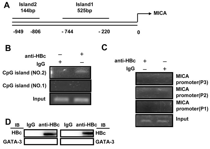 HBV core protein inhibits MICA expression