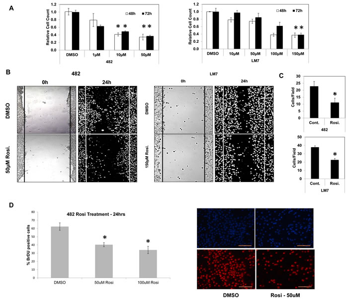 TZD treatment decreases cell proliferation and migration in osteosarcoma cells.