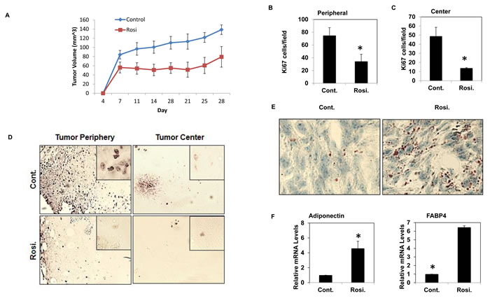 TZD treated mice have reduced tumor volume and increased adipogenesis.