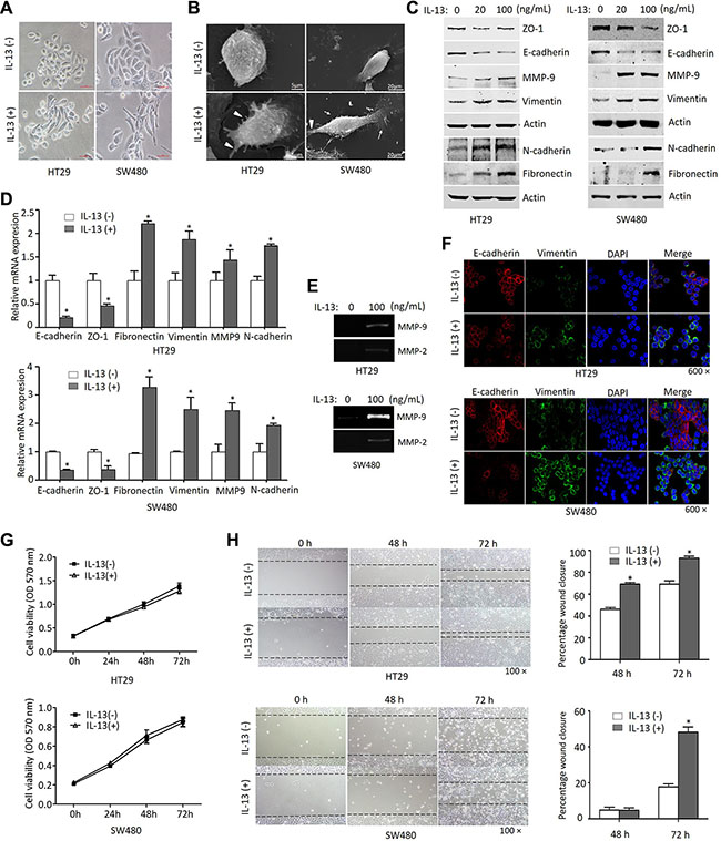 IL-13 induces an EMT phenotype in CRC cells.