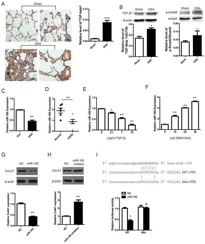 miR-185 is repressed by TGF-&#x3b2; and regulates pulmonary remodeling through CoLA1.