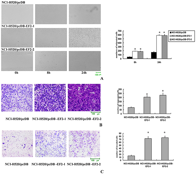 The effect of EF2 overexpression on cell migration and invasion.