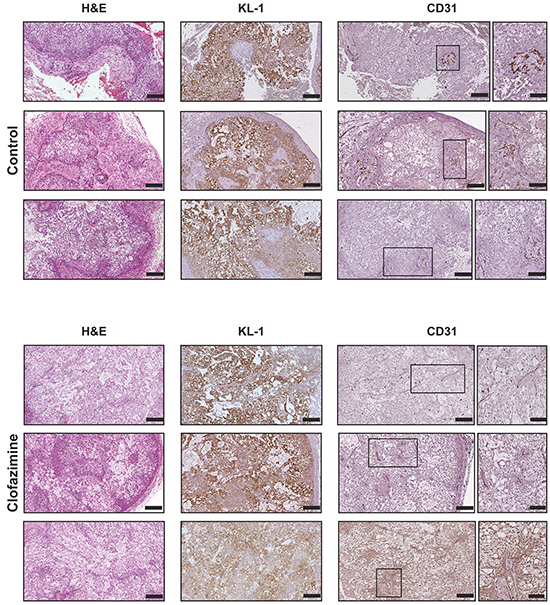 Immunohistochemical analysis of PDAC tissues reveal no gross alterations of tumor structure and angiogenesis upon clofazimine treatment.