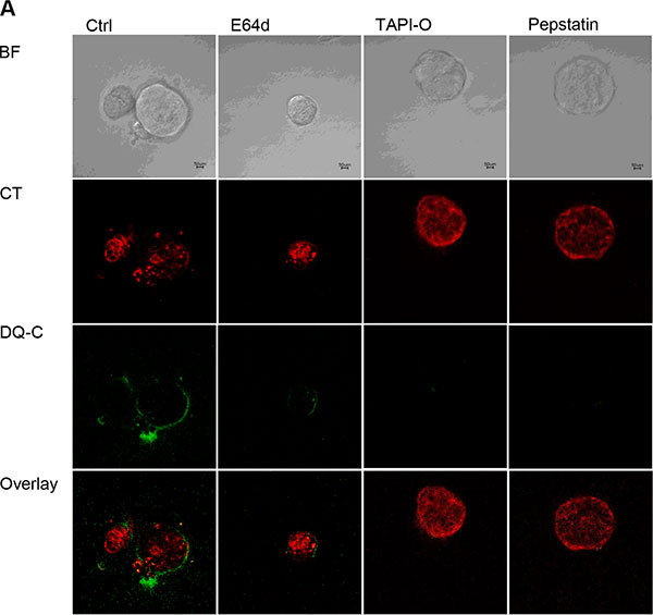 Influence of protease inhibitors on TIC dependent collagen cleavage.
