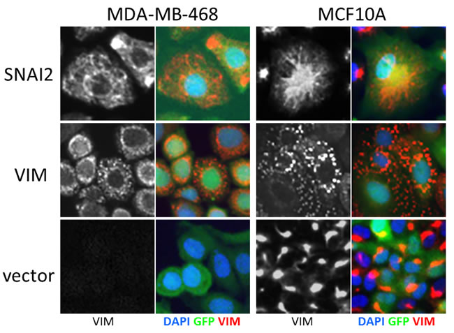 Effect of control virus on VIM fibre morphology in MCF10A and MDA-MB-468 cells.