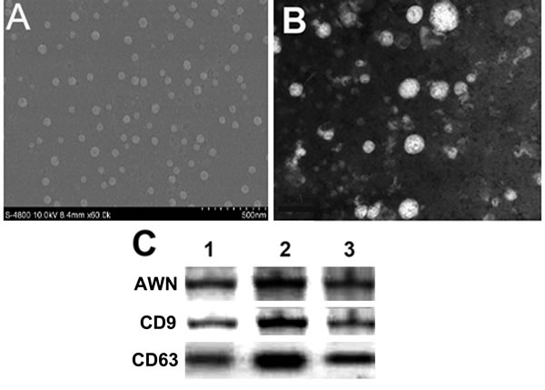 Identification of boar seminal plasma exosomes.
