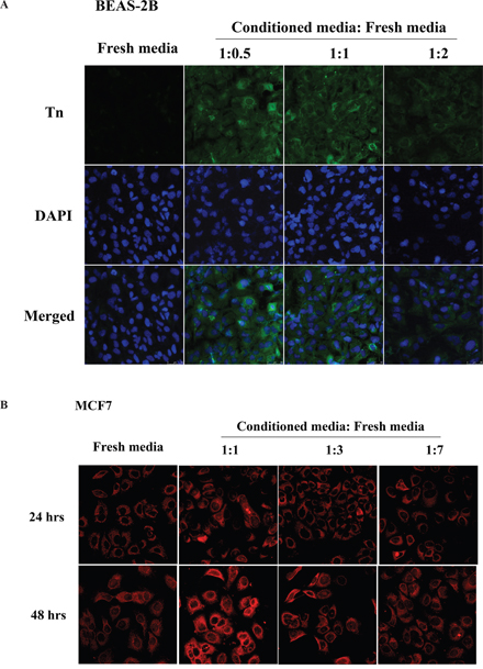 Conditioned media from oncogenic Ras-transformed cells and MCF7 breast cancer cells up-regulate Tn levels.
