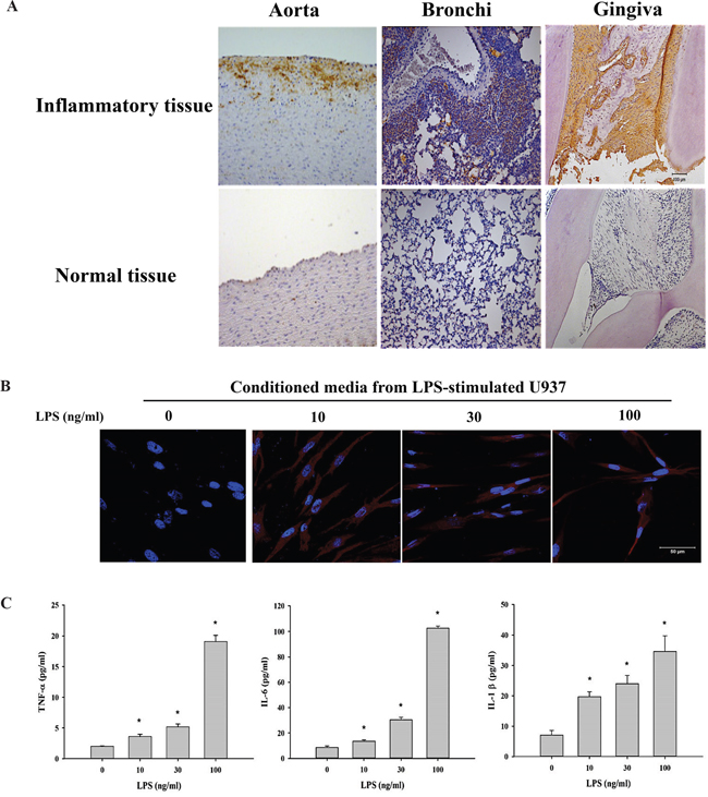 Tn levels is up-regulated in inflammatory tissues and cells.