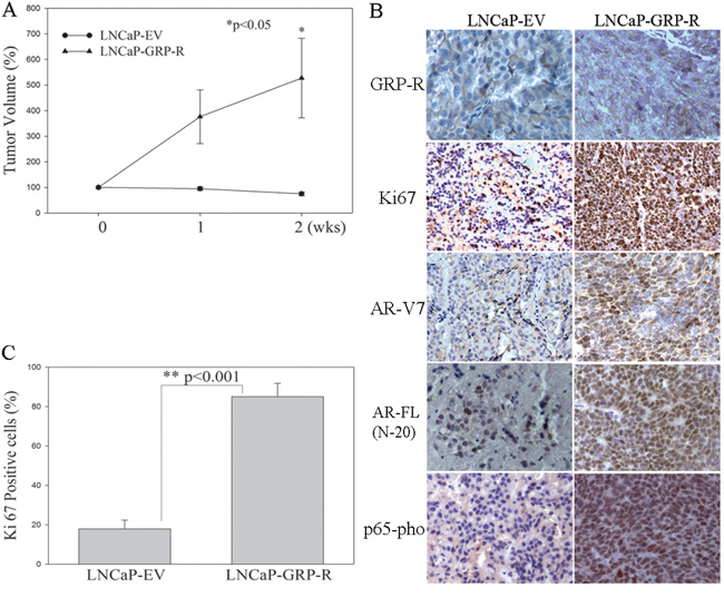 Overexpression of GRP-R increases ARVs expression and contributes to androgen dependent PC tumors to grow in the castrated mice.