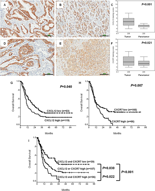 Expression, clinicopathologic and prognostic significances of CXCL12 and CXCR7 in Beijing cohort of PC.