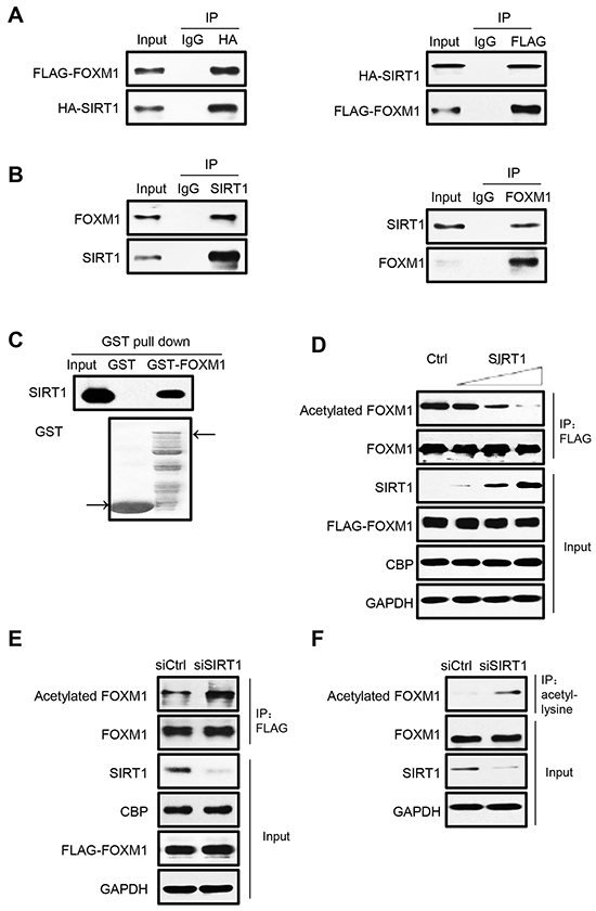 FOXM1 is deacetylated by SIRT1 in vivo.