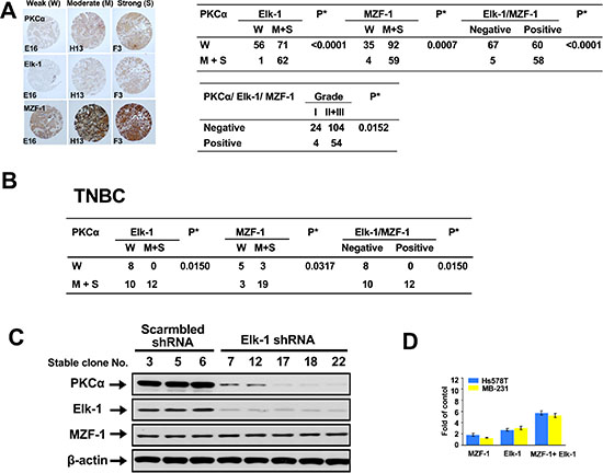 Correlations between PKC&#x03B1; expression and Elk-1/MZF-1 expression in breast cancer.