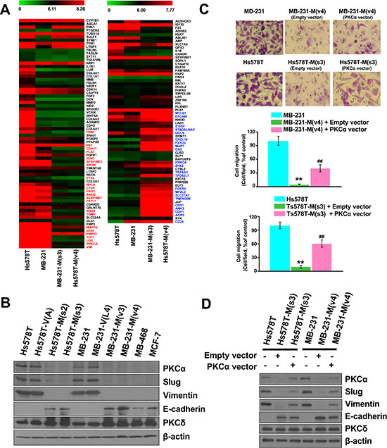 Disrupting the interaction between MZF-1 and Elk-1 decreases EMT potential.