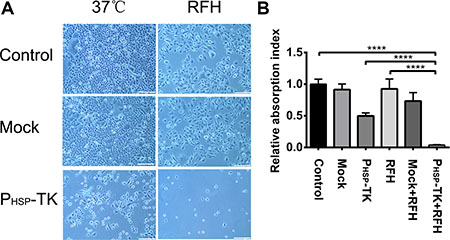 Results of in vitro experiments showing the cell phenotypes of MCF7/Adr after RFH-mediated gene therapy.