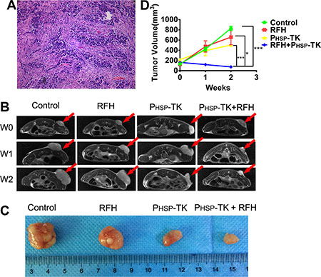 Results of in vivo experiments demonstrating tumor volume changes among the four animal study groups with different treatments.