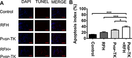 Apoptosis assay of tumor tissues.