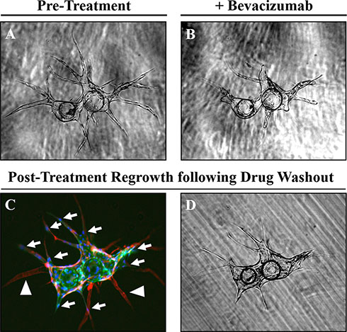 Regression and regrowth of established vessels along pre-defined basement membrane tracts.