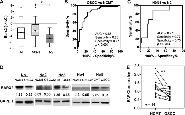 Down-regulation of BARX2 expression in OSCC.