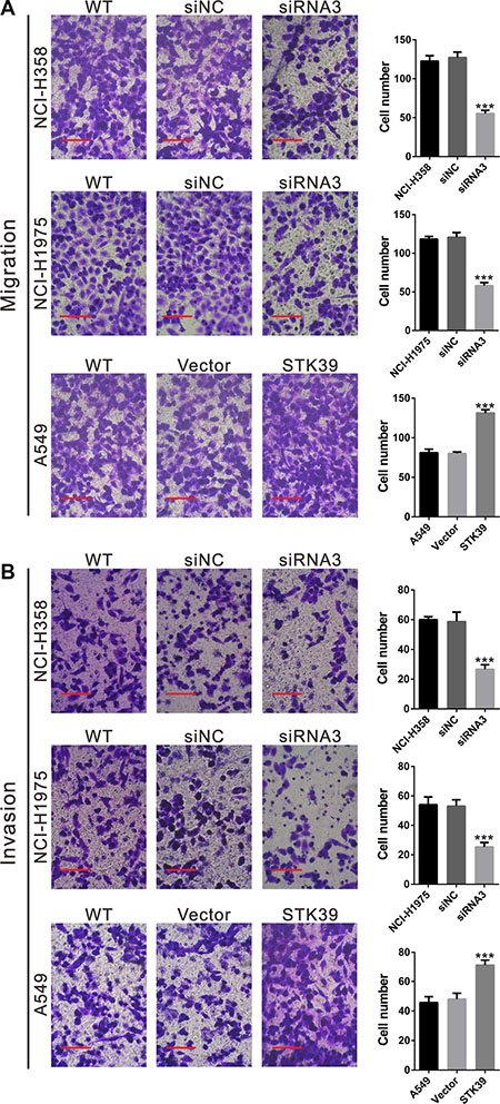 STK39 promotes the cellular migration and invasion of NSCLC cells.