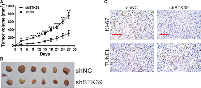 STK39 knockdown suppressed NSCLC cell proliferation in vivo.