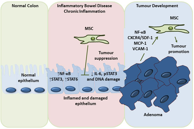 Dual role of MSC in the prevention of inflammation induced colon cancer development and promotion of colon cancer metastasis.