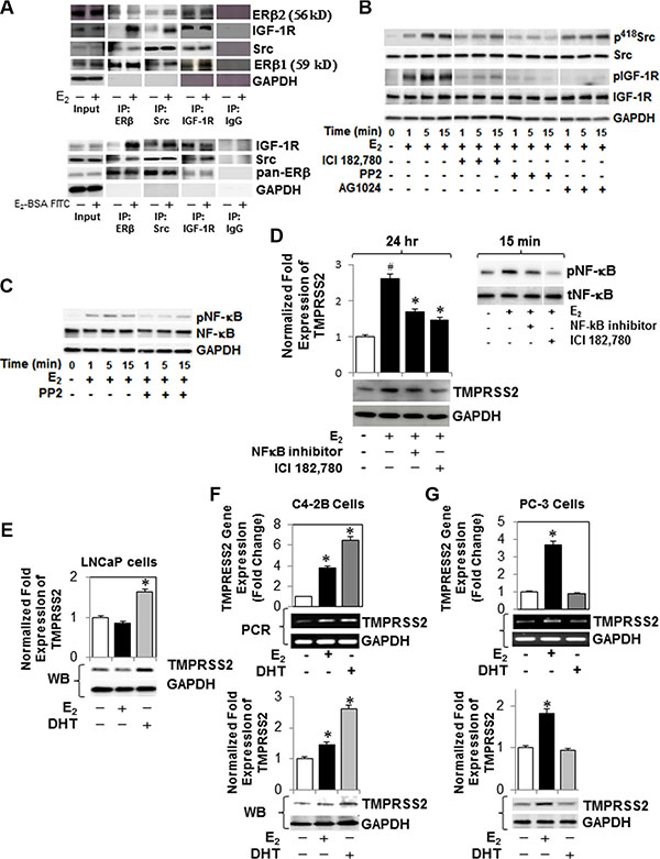 E2-ER&#x03B2;2 signaling axis primes Src (p418Src)-dependent activation of IGF-1R and NF-&#x03BA;B and expression of TMPRSS2 in PC-3 cells.