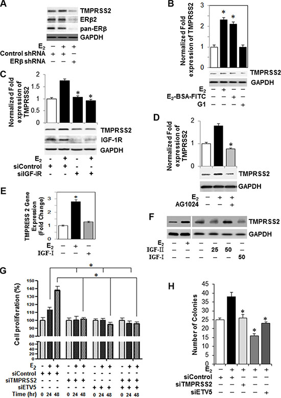 TMPRSS2, ETVs and TMPRSS2:ETV5 gene fusions are involved in an IGF-1R-dependent growth stimulatory effect of E2-ER&#x03B2;2 axis in PC-3 cells.