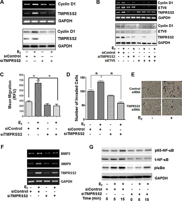 ETV5 and TMPRSS2-ETV5 gene fusions prime E2-ER&#x03B2;2 mediated growth and migration of PC-3 cells through NF-&#x03BA;B dependent expression of cyclin D1 and MMPs in PC-3 cells.