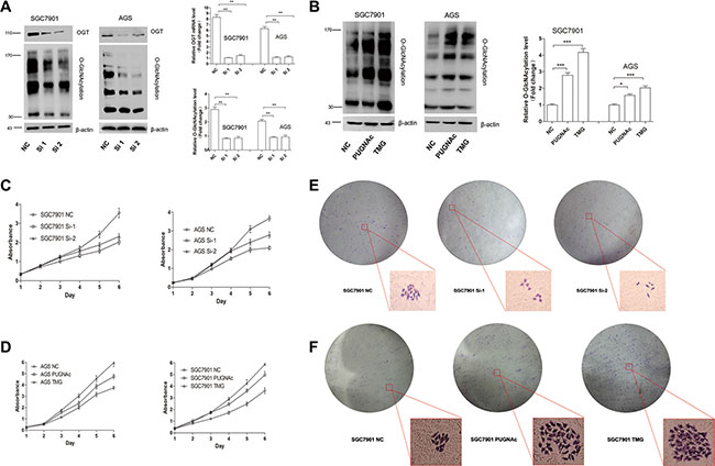 O-GlcNAcylation is associated with gastric cancer cell proliferation in vitro