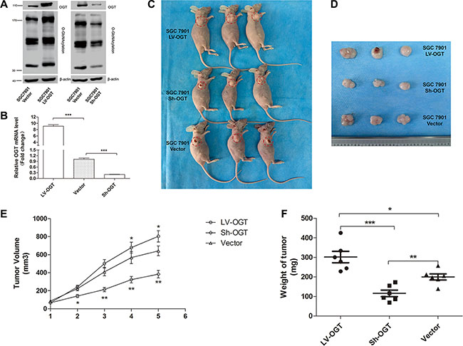 Effect of O-GlcNAcylation on gastric tumor growth in a xenograft model.